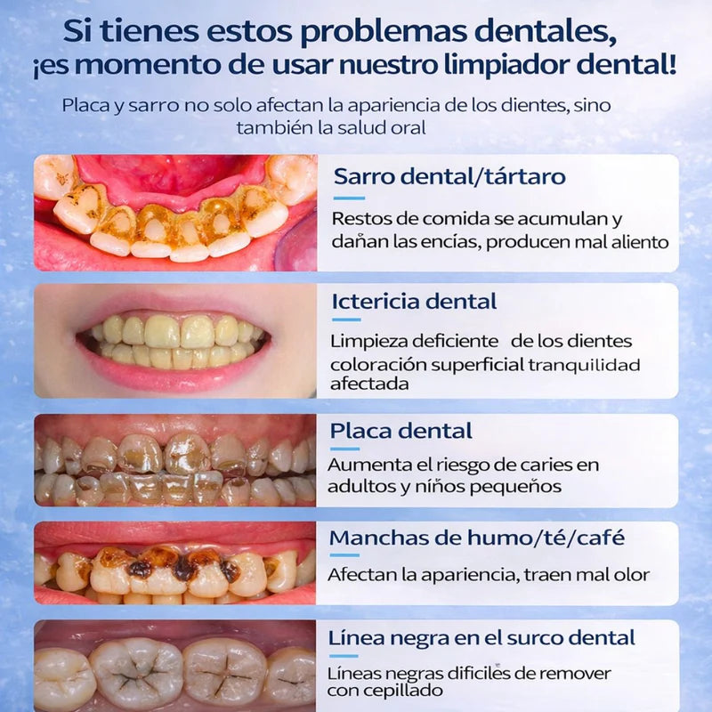 Limpiador Dental Ultrasónico Eléctrico Recargable Con Pantalla LED. Removedor Bucal De Sarro Y Placa Con 5 Modos De Limpieza, Impermeable IPX6 (Incluye 6 Cabezales) LT590